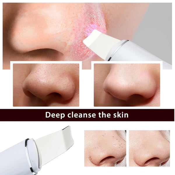 Ultrasonic Skin Scrubber – EMS Peeling Shovel for Deep Facial Cleansing & Lifting