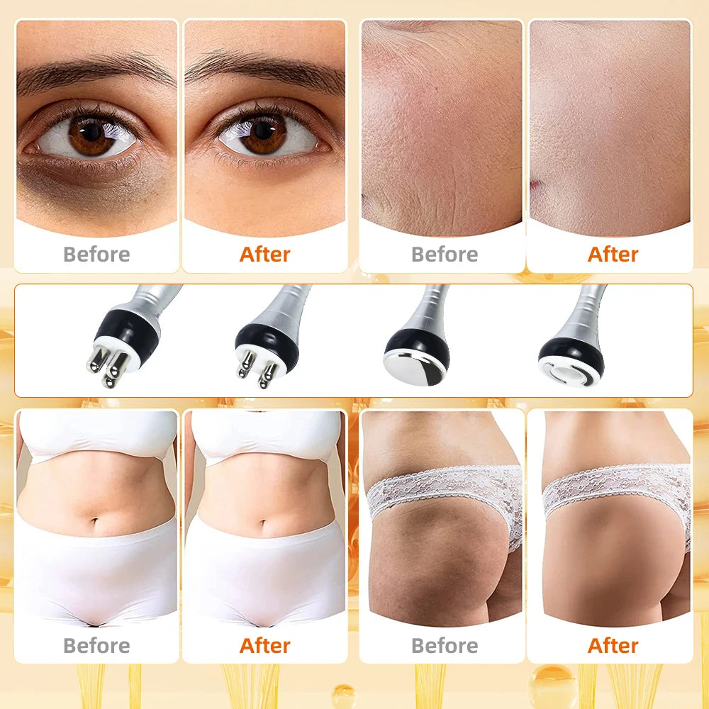 4-in-1 Cavitation Slimming & Lifting System