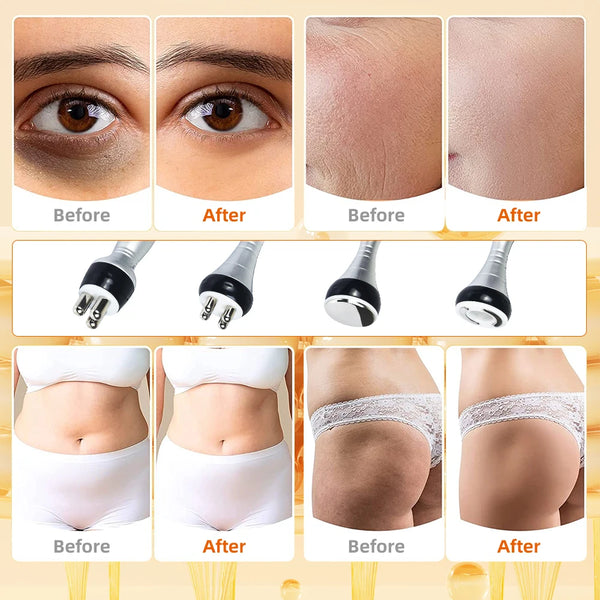 4-in-1 Cavitation Slimming & Lifting System