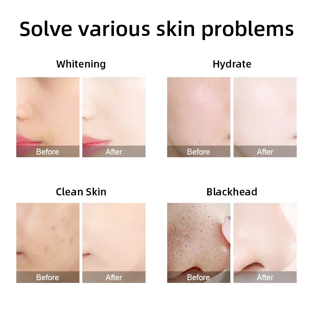 Professional Beauty Facial Machine
