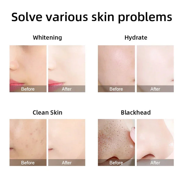 Professional Beauty Facial Machine