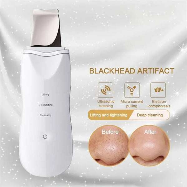 Ultrasonic Deep Cleaning Face Scrubber