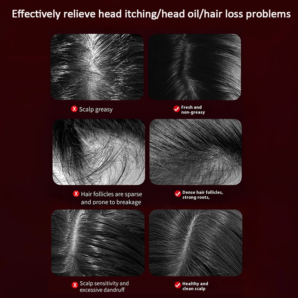 Red Light Therapy Scalp Brush