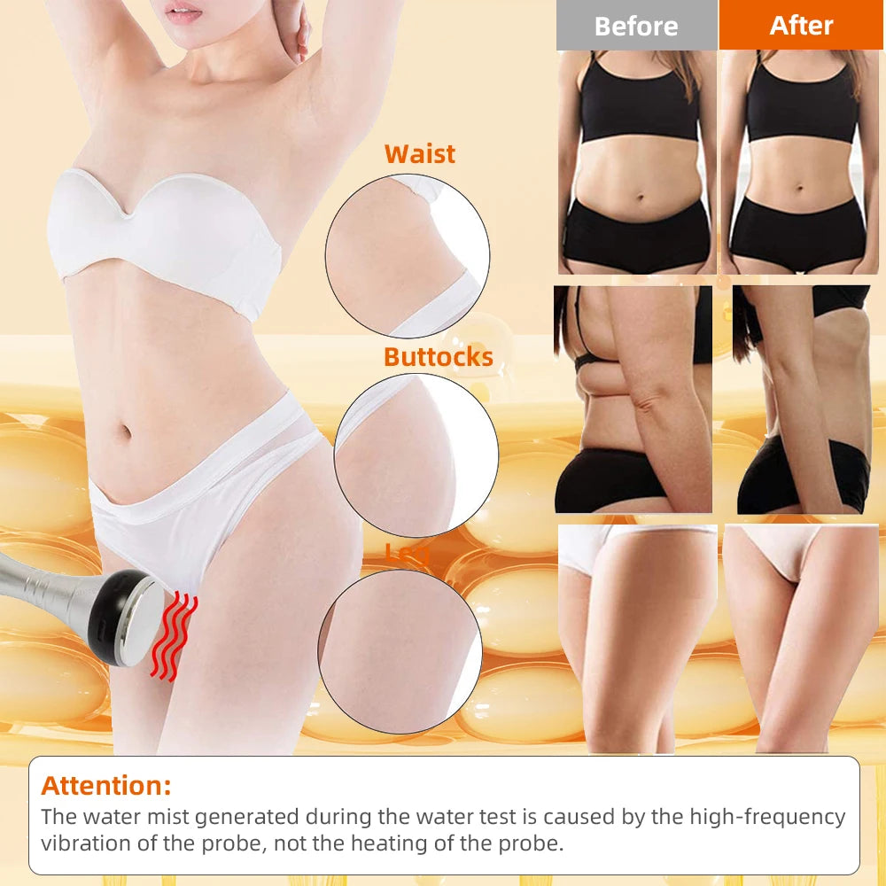 4-in-1 Cavitation Slimming & Lifting System