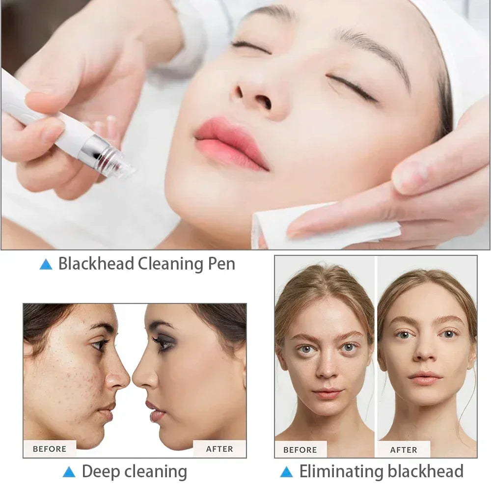 Professional Beauty Facial Machine