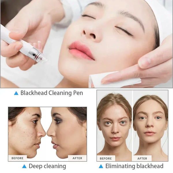 Professional Beauty Facial Machine