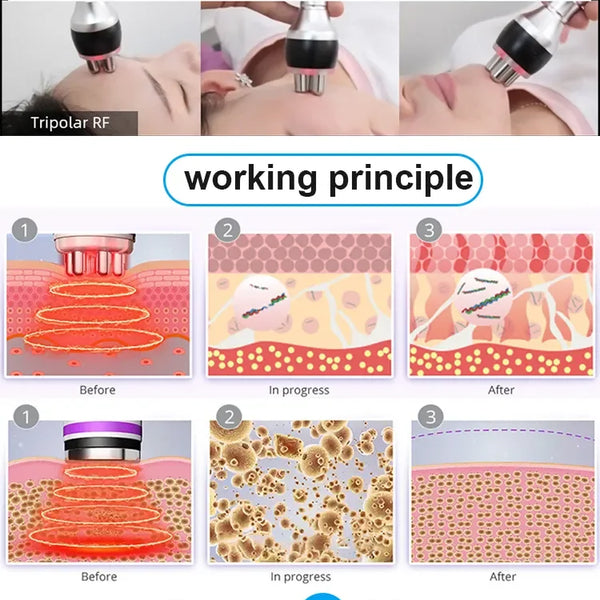 4-in-1 Cavitation Slimming & Lifting System
