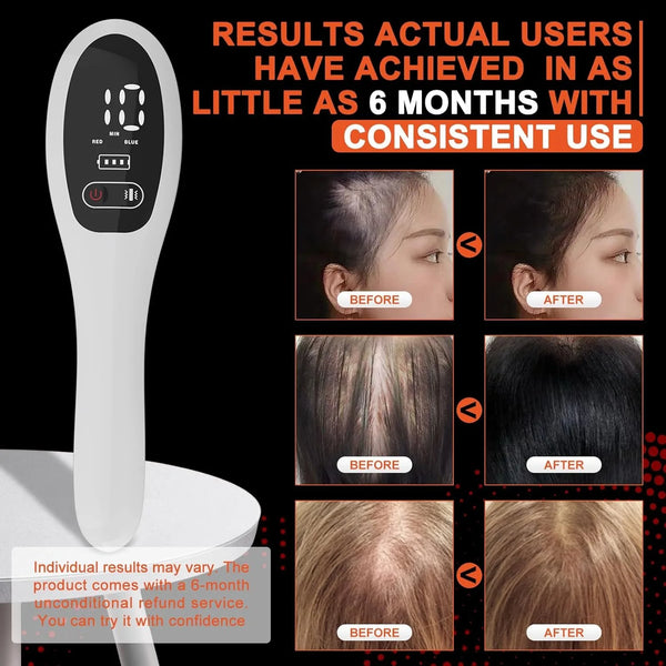LED Red Light Therapy for Hair Loss & Scalp Massage