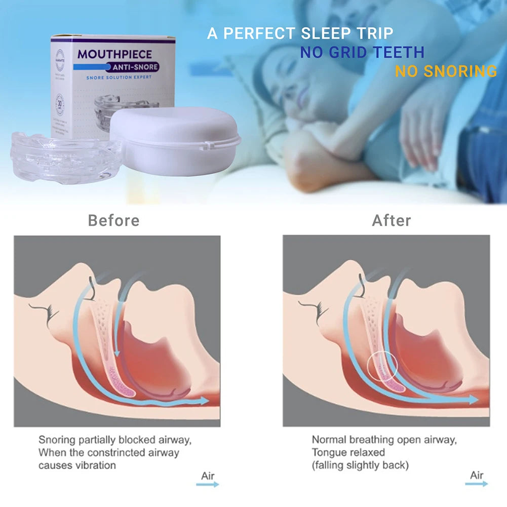 Reusable Anti-Snore Mouthpiece